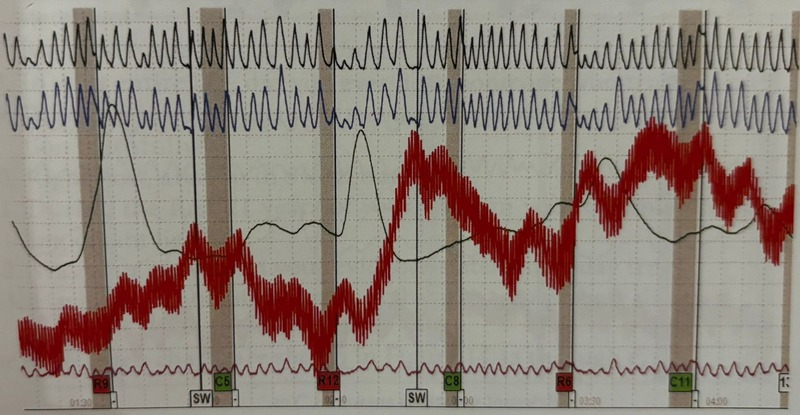 Lügendetektortest in Saarbrücken / Polygraphentest